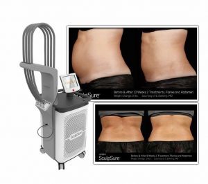 Sculpsure-Body-Contouring-Laser-fat-reduction-southfield-mi